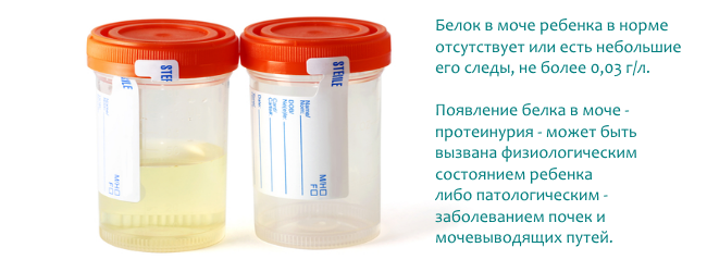 С чем связано повышенный белок в моче С чем связано повышенный белок в моче